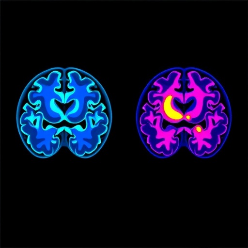 Brain- and Body-First Subtypes Identified in Lewy Body Disease