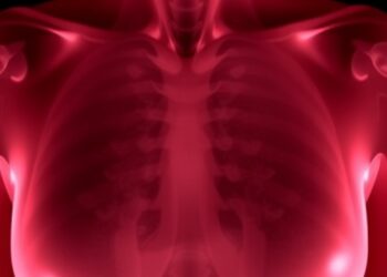 Cemiplimab and fianlimab with neoadjuvant chemotherapy in early-stage high-risk -negative breast cancer