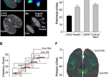 cGAS-mediated type I IFN signaling contributes to disease progression in drug-refractory epilepsy