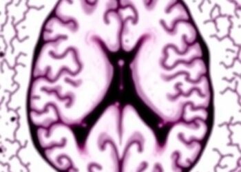 Clinicopathologic Study Reveals Amyloid Clearance in Alzheimer’s Disease