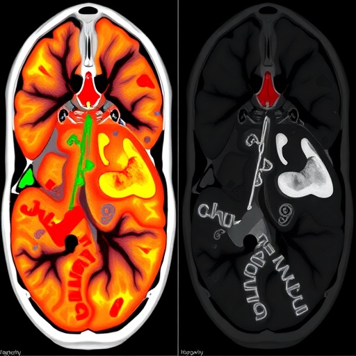 CODAvision enables fast, user-friendly customizable medical image segmentation