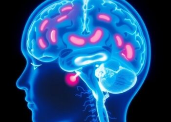 Common thyroid hormone may prevent childhood brain tumor relapse