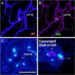 Coordinated Vascular and Glial Cell Response in Pig Sepsis Model