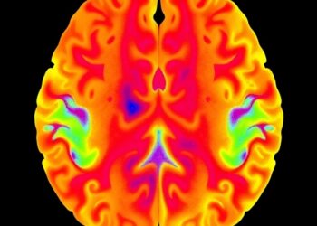 Core2Edge Glioblastoma Model Tracks Infiltration and Transcriptional Heterogeneity
