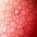 Cross-Species Spatial Transcriptomics Reveals Conserved Drivers of Lupus Skin and Hair Loss