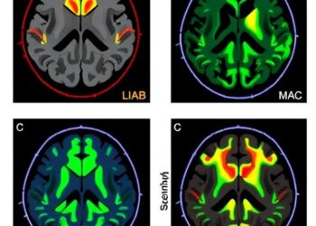 CUDC-907 boosts temozolomide response in glioblastoma by dual PI3K/HDAC inhibition