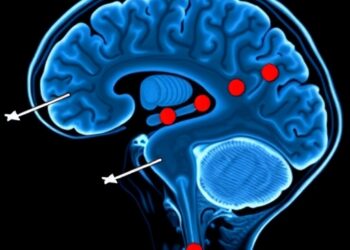 Deep Learning Detects REM Sleep Disorder and Parkinson’s Early via fMRI