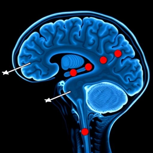 Deep Learning Detects REM Sleep Disorder and Parkinson’s Early via fMRI