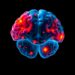 Depression Linked to Hippocampal Subfield Volume Changes in Older Adults