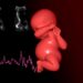 Echocardiography Hemodynamics in Preterm Infants Predict Neurodevelopment Through Age Three