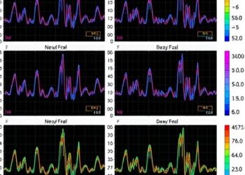 EEG Modeling Predicts Conversion and Reveals Diverse Outcomes in Isolated REM Sleep Disorder
