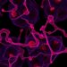 Endothelial CB1 receptor loss cuts arterial inflammation and lipid uptake