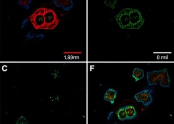 FGFR4-Associated APOBEC3 Mutagenesis Defines HER2-Enriched Human Breast Cancer Subtype