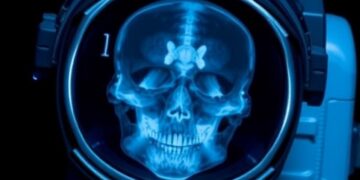 First Space Diagnostic X-rays Signal a New Era for Astronaut Health