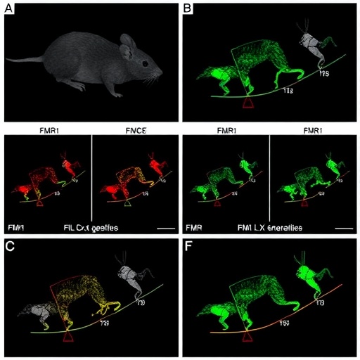FMR1 Gene Therapy Rescues Fragile X Syndrome Traits in Mice