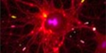 Focal Astrocyte Loss Shows Nuclear Translocation During Lesion Repopulation