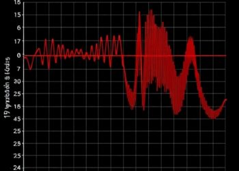 Gamma and beta rhythms and 1/f slope shift with depression severity