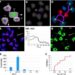 Human milk exosomal miR-144-5p reduces NEC by modulating TLR4/NF-κB