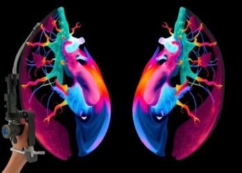 Hybrid system enables real-time freehand 3D panoramic photoacoustic angiography mapping