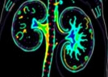Immune Profiling Predicts Response to Radiation and Anti-PD-1 in Kidney Cancer