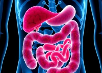 Ketogenic Diet Drives Intestinal Tumor Growth via Lipids, Not Ketones
