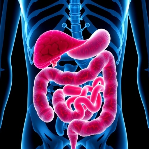 Ketogenic Diet Drives Intestinal Tumor Growth via Lipids, Not Ketones