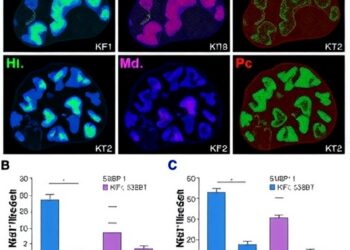 KIF14 silencing boosts chemosensitivity by altering 53BP1 in medulloblastoma