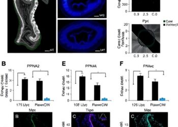 KPNA2 overexpression worsens T4 colorectal cancer prognosis by nuclear c-Myc suppression of p21