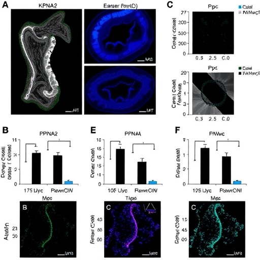 KPNA2 overexpression worsens T4 colorectal cancer prognosis by nuclear c-Myc suppression of p21