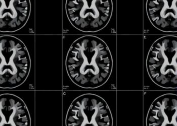 Large-Scale Multi-Sequence Pretraining Enhances MRI Analysis Across Clinical Applications