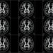 Large-Scale Multi-Sequence Pretraining Enhances MRI Analysis Across Clinical Applications