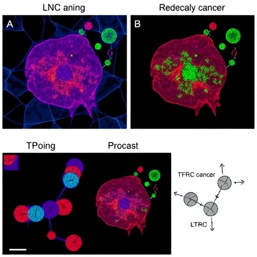 LINC01929 Drives Breast Cancer via TFRC-Linked Ferroptosis Pathway