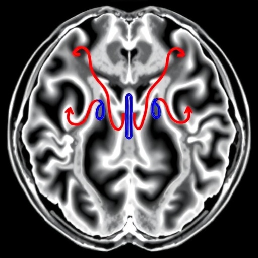 Link Between Carotid Hemodynamics and Cerebral Blood Flow in Early Simulated Microgravity