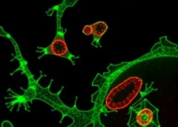 Local Complement C3 Shapes Control Myeloid Infiltration and Checkpoint Blockade Efficacy