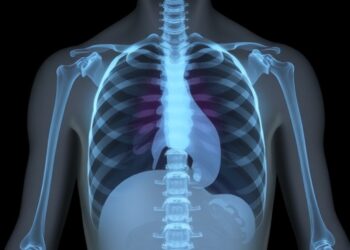 Long-Term Exposure to Six Air Pollutants Linked to Parkinson’s Disease Risk