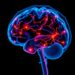 Magnesium Sulfate May Protect Newborn Brains in Neonatal Encephalopathy