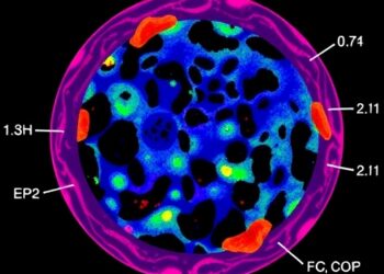 Mapping Tumor Microenvironment Immune Pathways in Immunotherapy-Treated Melanoma
