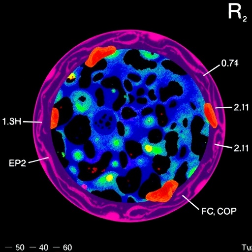 Mapping Tumor Microenvironment Immune Pathways in Immunotherapy-Treated Melanoma