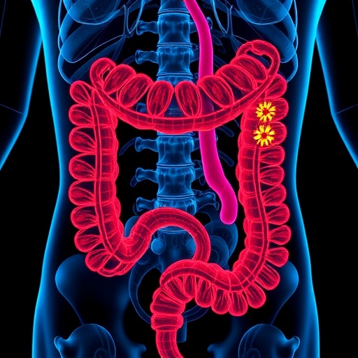 Mitochondrial Metabolism Predicts Chemotherapy Sensitivity in Colorectal Cancer