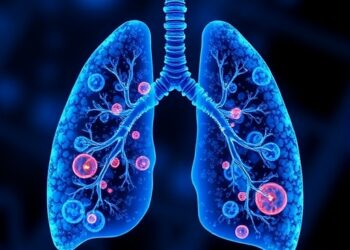 Multi-metal cooperation drives lung cancer chemoresistance, reversed by MiADMSA
