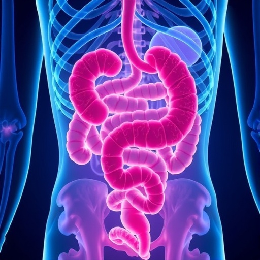 Necrotizing Enterocolitis: A Paradigm Shift in Understanding