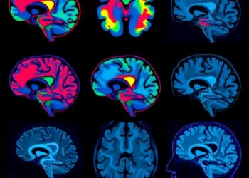 Neuroimaging Links to Depression Found in Six Large Population Studies