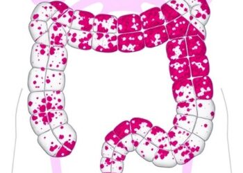 Novel Prognostic Biomarker and Oncogenic Driver Identified in Colorectal Cancer
