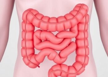 Older Age and Stage Predict Recurrence, Mortality After Curative Colorectal Cancer Resection