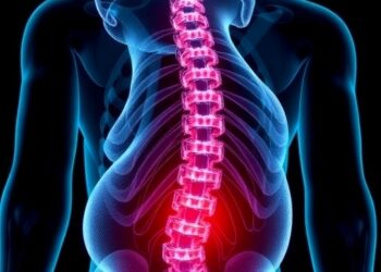 Osteoclasts Trigger DCC Loop Causing Chronic Low Back Pain in Mice