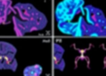 Pathology-CoT Trains Visual Chain-of-Thought Agents Using Expert Whole-Slide Diagnoses