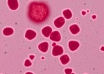 Peripheral Blood Mononuclear Cell Deformability Reduced in Major Depressive Disorder
