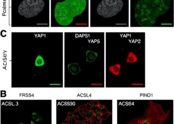 PIN1 boosts YAP1 SUMOylation and blocks ferroptosis through autophagy-driven ACSL4 degradation in cervical cancer