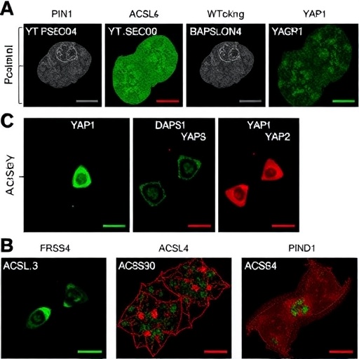 PIN1 boosts YAP1 SUMOylation and blocks ferroptosis through autophagy-driven ACSL4 degradation in cervical cancer