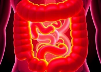 Prioritized research agenda set for necrotizing enterocolitis